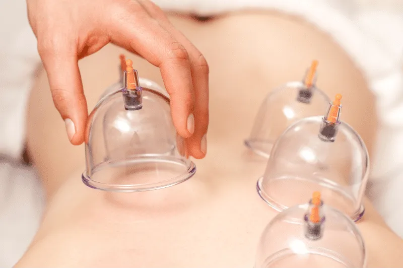 cupping for low back pain